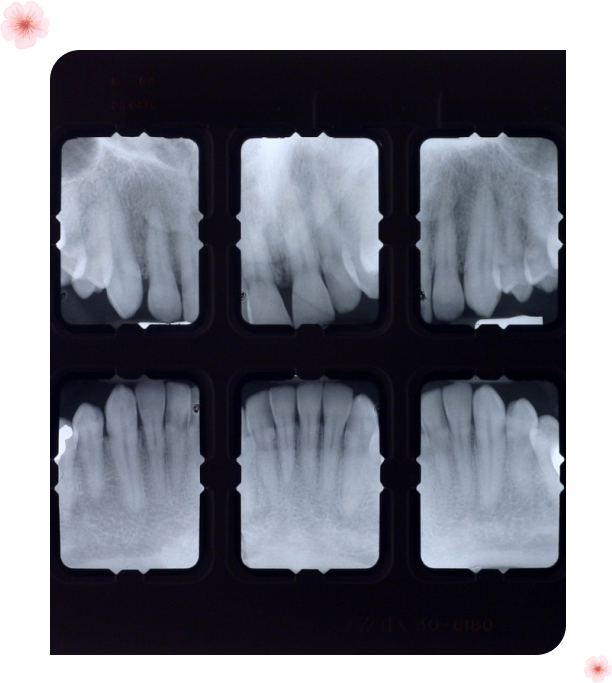 Dental X-Ray machine for General Dental Services at Cherry Blossom Dentistry